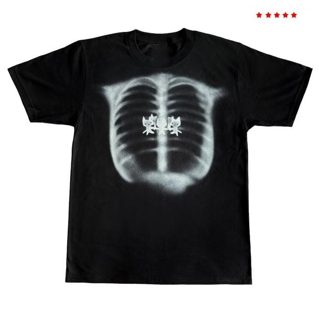 X-Ray Shirt