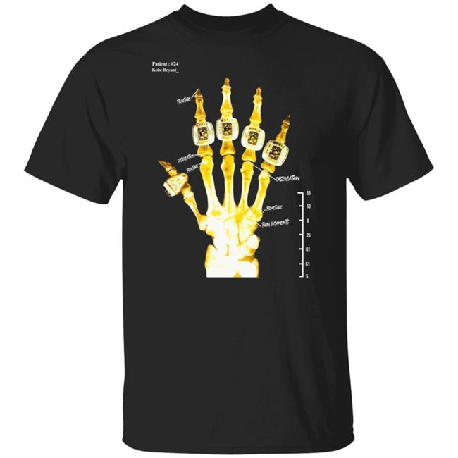 Hand X Ray Broken Not Beaten Tee